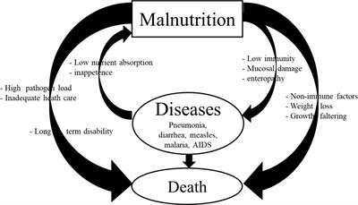 Mechanisms of Kwashiorkor-Associated Immune Suppression: Insights From Human, Mouse, and Pig Studies